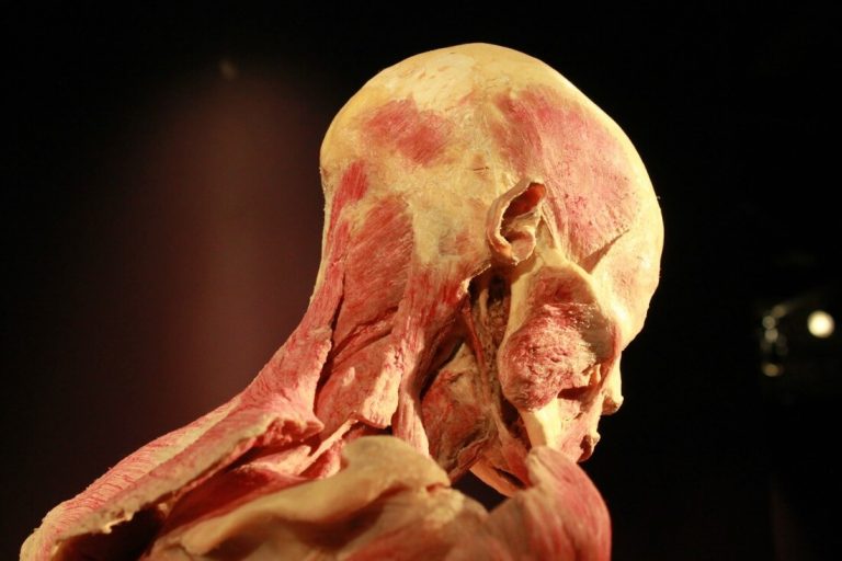 real_bodies